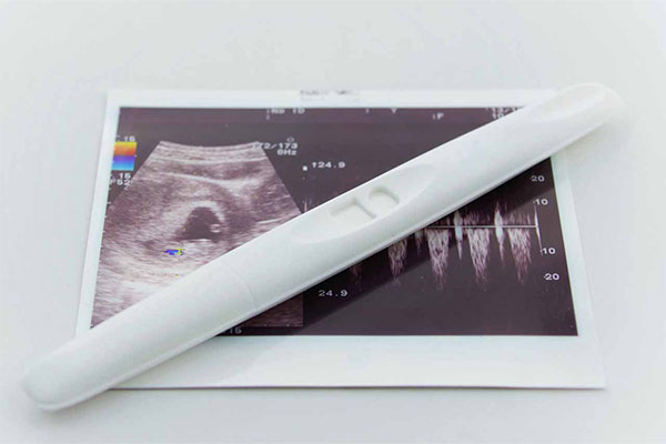 妊娠初期症状って？検査薬を使うのはいつ？受診のタイミングや気をつけること