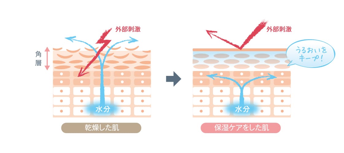 皮フの断面図(イメージ)