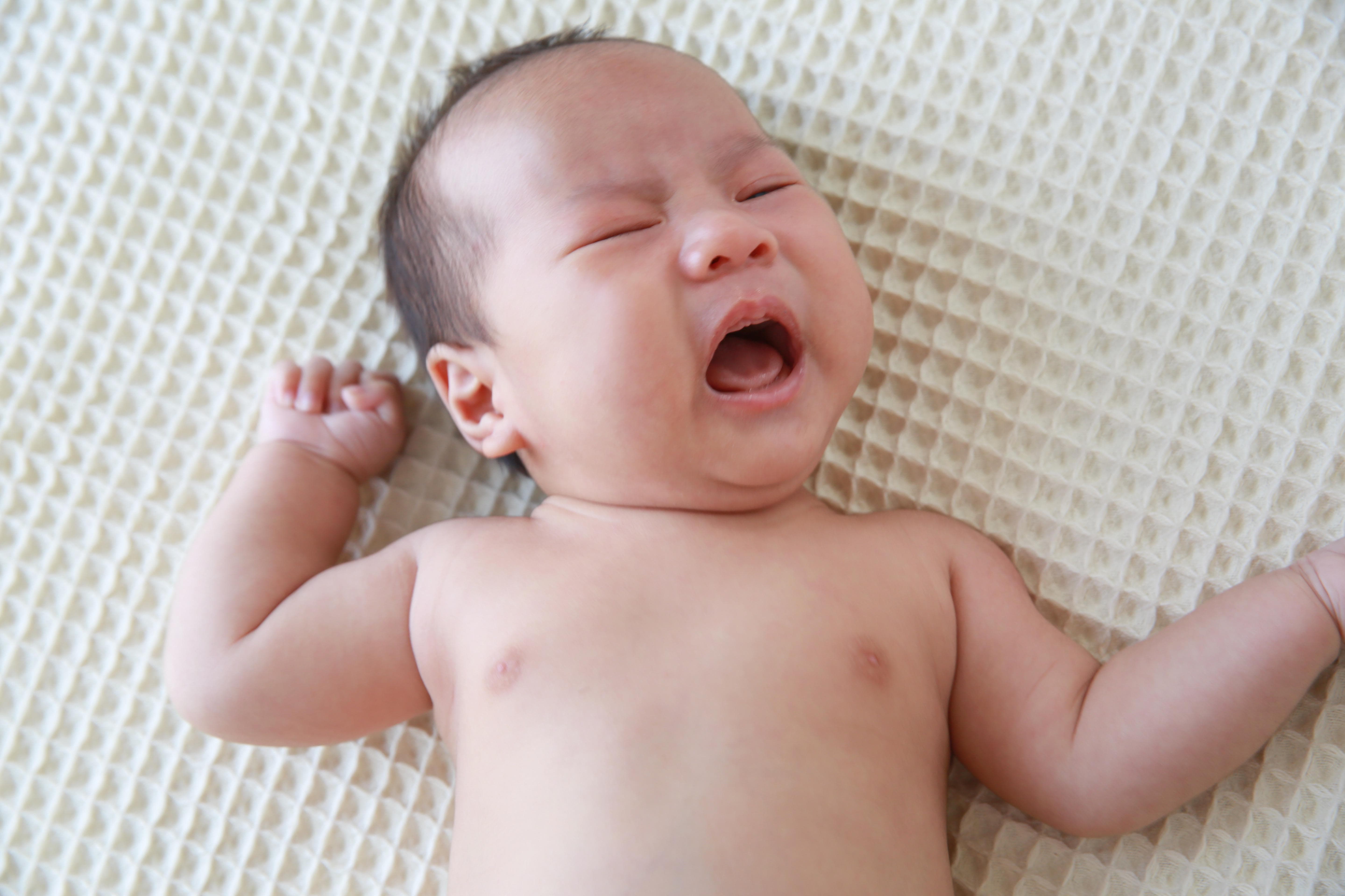 赤ちゃんの肌トラブルの対処法は 皮膚科 小児科のどっち ママのはじめてサポートサイト ピジョンインフォ
