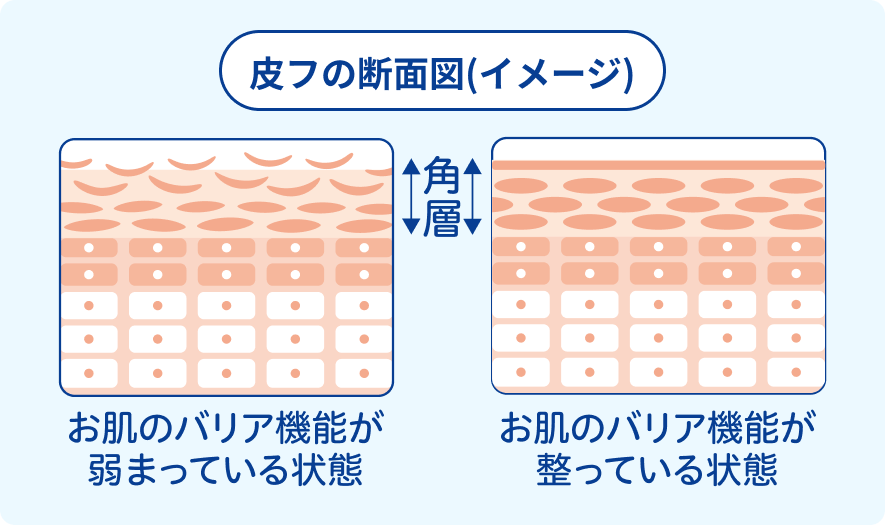 皮フの断面図（イメージ）